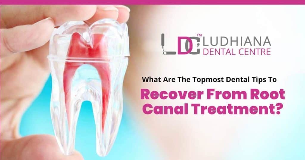 Root canal treatment recovery tips at Ludhiana Dental Centre, expert dental care and advice for post-procedure healing.