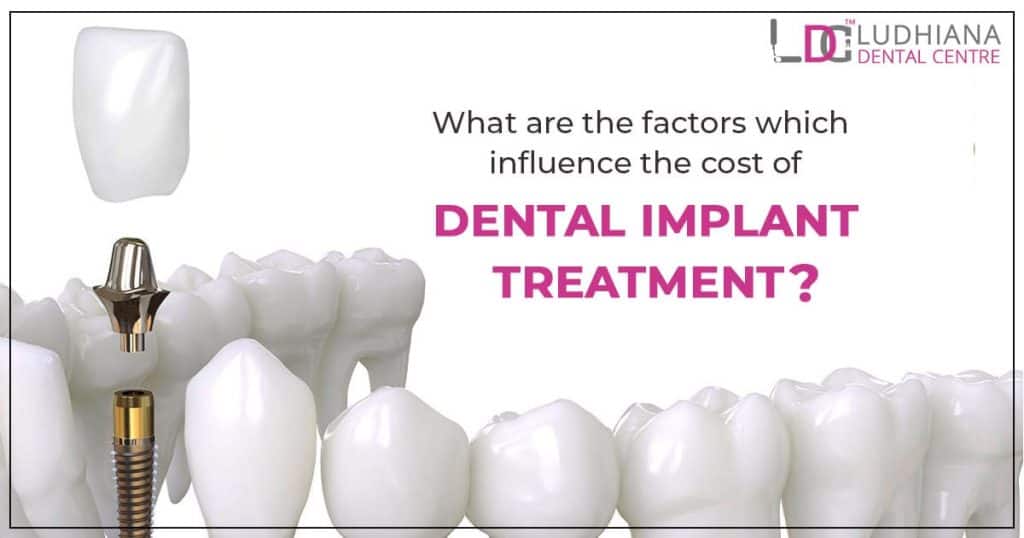 Dental implant treatment cost in Ludhiana, implant dentistry, Ludhiana Dental Centre.