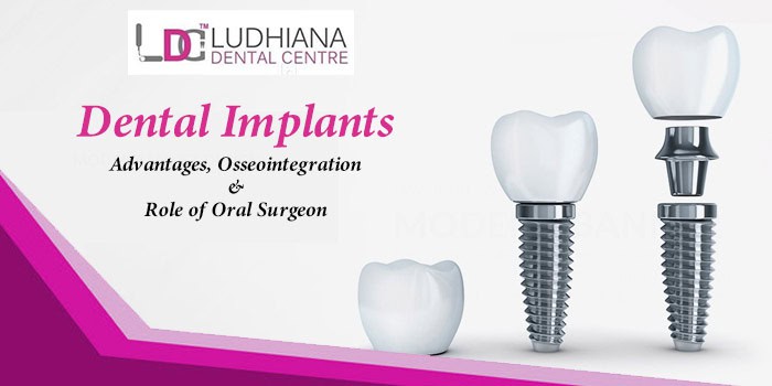 Dental implants in Ludhiana for improved oral health and confidence. Expert osseointegration and oral surgeon services.