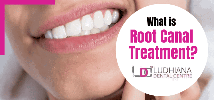 Root canal treatment dental care in Ludhiana at Ludhiana Dental Centre.