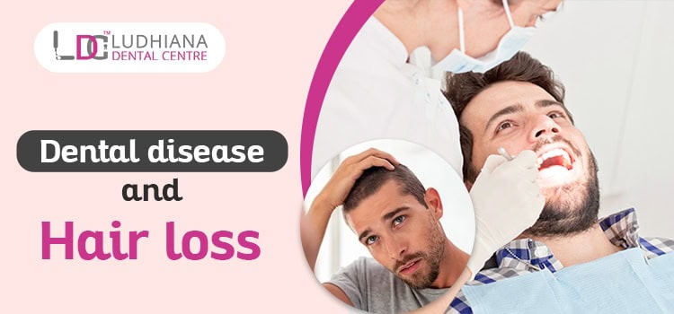 Dental-disease-and-hair-loss-ludhiana-dental