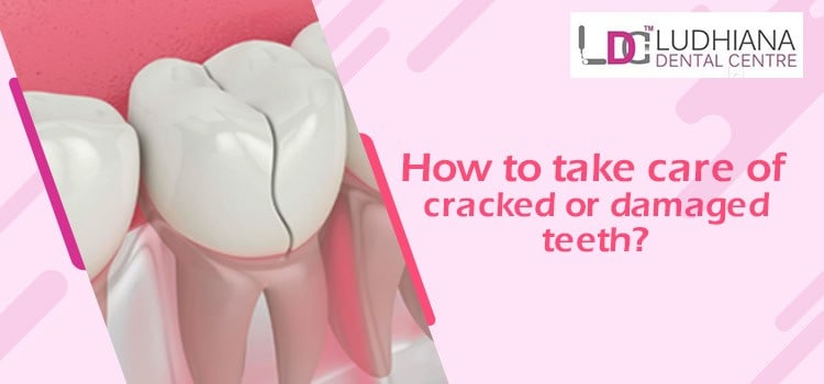 Cracked tooth dental care Ludhiana Dental Centre.