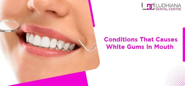 Dental care at Ludhiana Dental Centre, expert services for healthy teeth and gums.