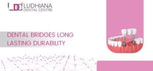Dental bridges for long-lasting durability at Ludhiana Dental Centre. Expert restorative dental solutions in Ludhiana.