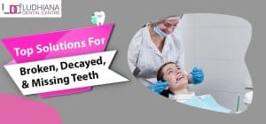 Ludhiana dental center dental clinic for teeth restoration and cosmetic dentistry.