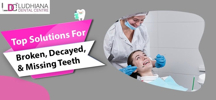 Ludhiana dental center dental clinic for teeth restoration and cosmetic dentistry.