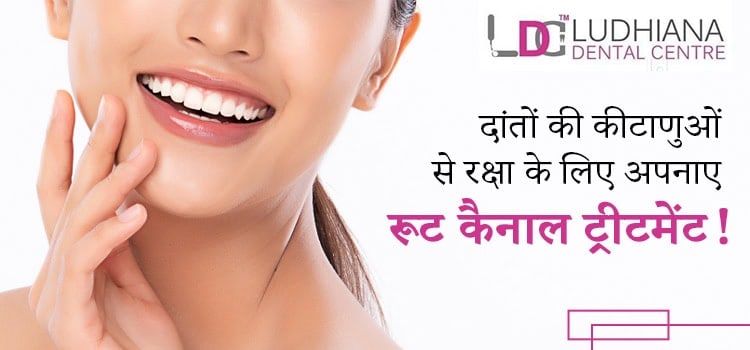 दांतों-की-कीटाणुओं-से-रक्षा-के-लिए-अपनाए-रूट-कैनाल-ट्रीटमेंट-!