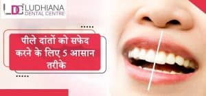 पीले-दांतों-को-सफेद-करने-के-लिए-5-आसान-तरीके