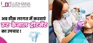 अब-ठीक-लागत-में-करवाएं-रूट-कैनाल-ट्रीटमेंट-का-उपचार-!