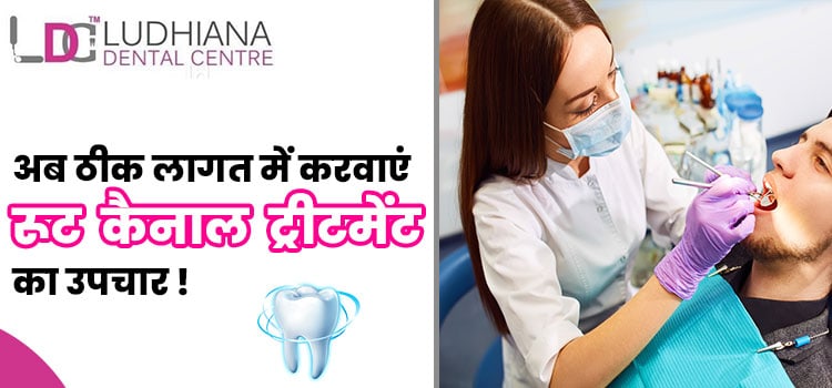अब-ठीक-लागत-में-करवाएं-रूट-कैनाल-ट्रीटमेंट-का-उपचार-!