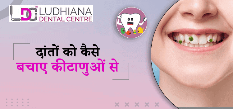 दांतों को कैसे बचाए कीटाणुओं से !