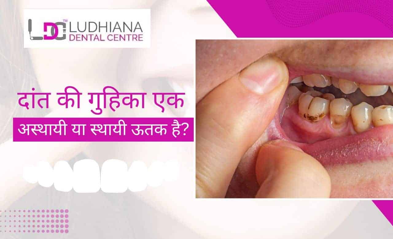 दांत की गुहिका एक अस्थायी या स्थायी ऊतक है?