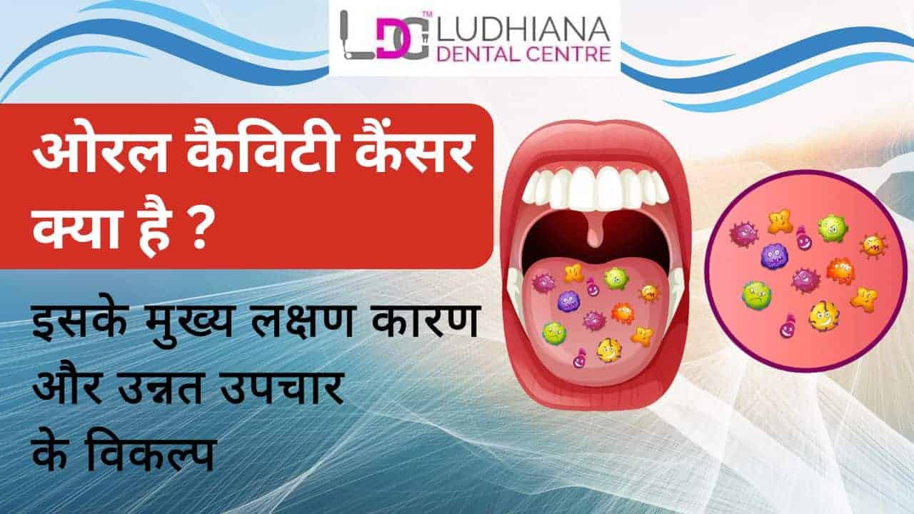 ओरल कैविटी कैंसर लक्षण, कारण और उन्नत उपचार विकल्प