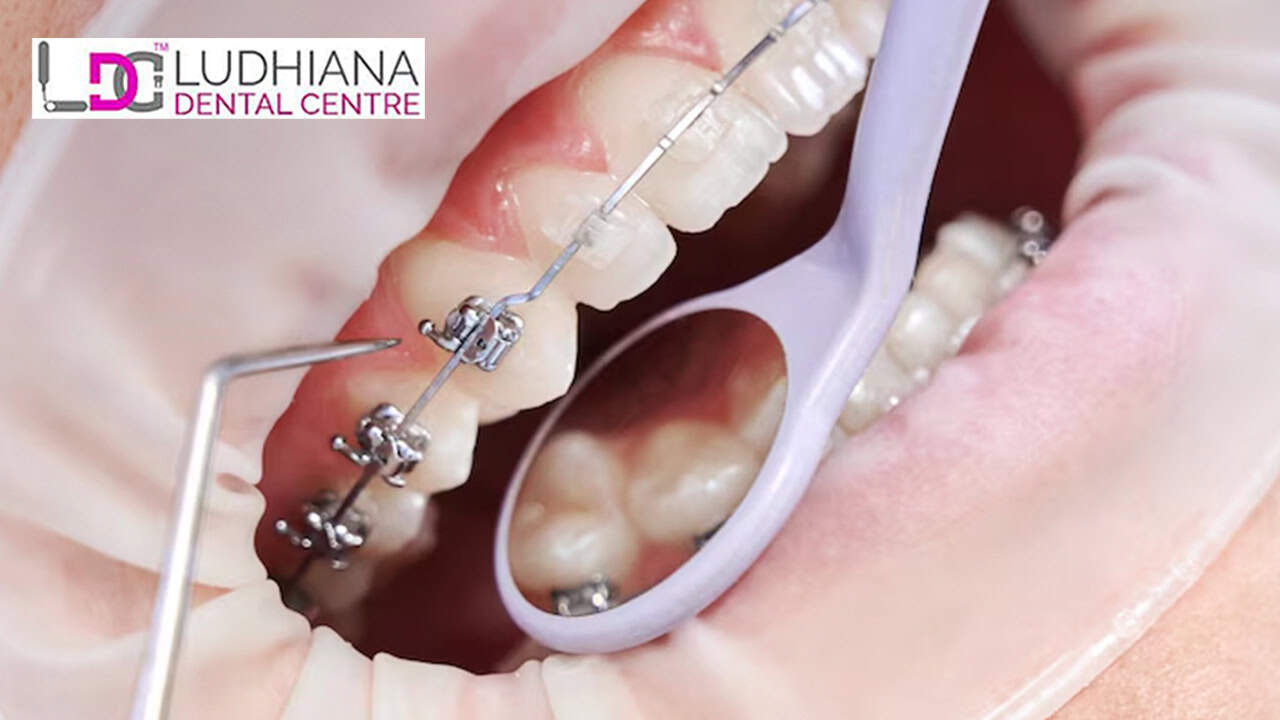 Innovative Technologies Redefining Advanced Orthodontics