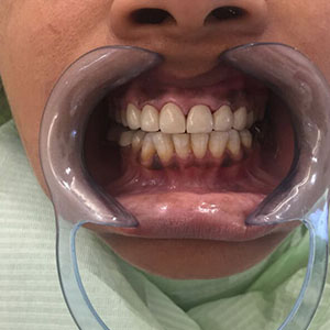 High-quality dental care at Ludhiana Dental Centre for healthy, beautiful smiles.