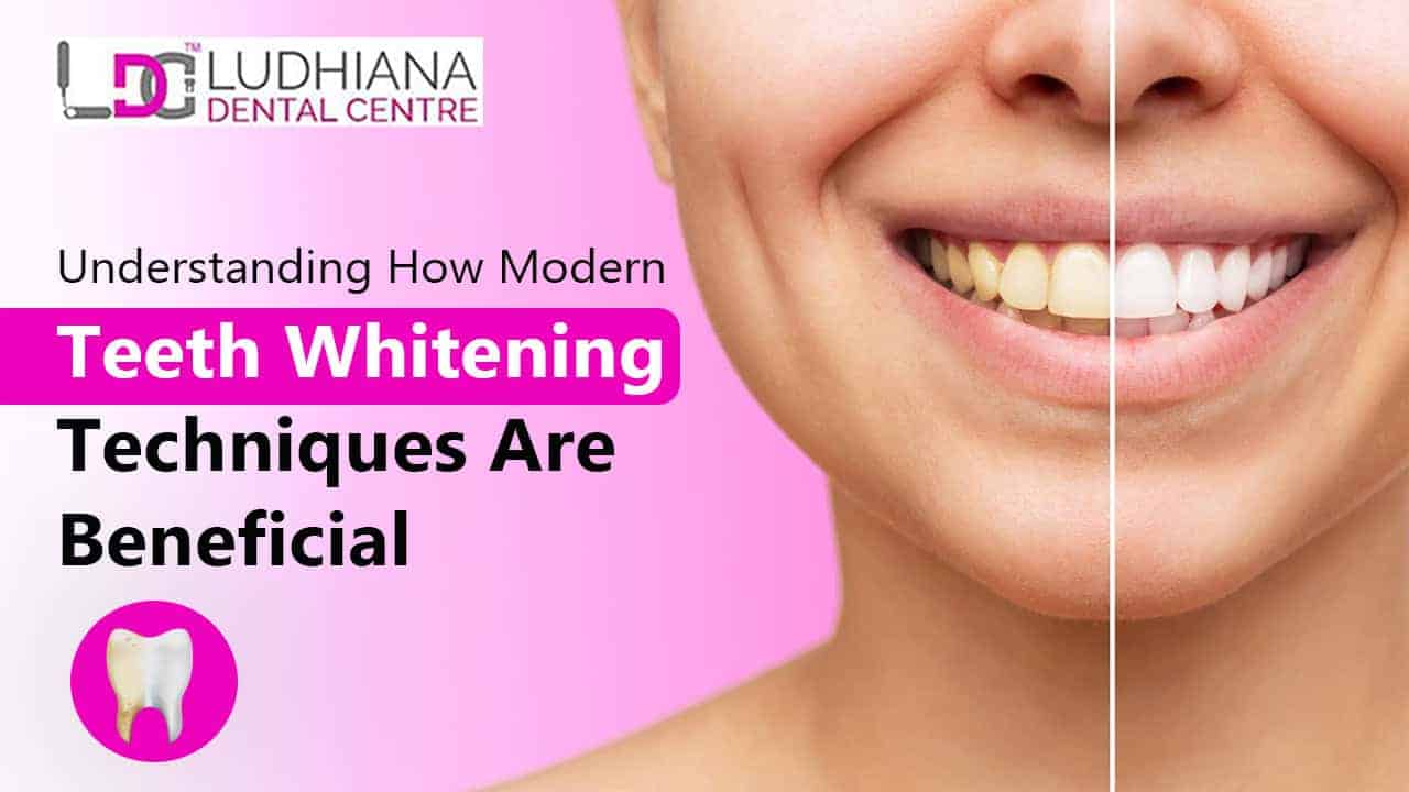 Ludhiana Dental Centre teeth whitening before and after smile comparison.