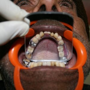 Dental checkup at Ludhiana Dental Centre, oral health care in Ludhiana, Punjab.