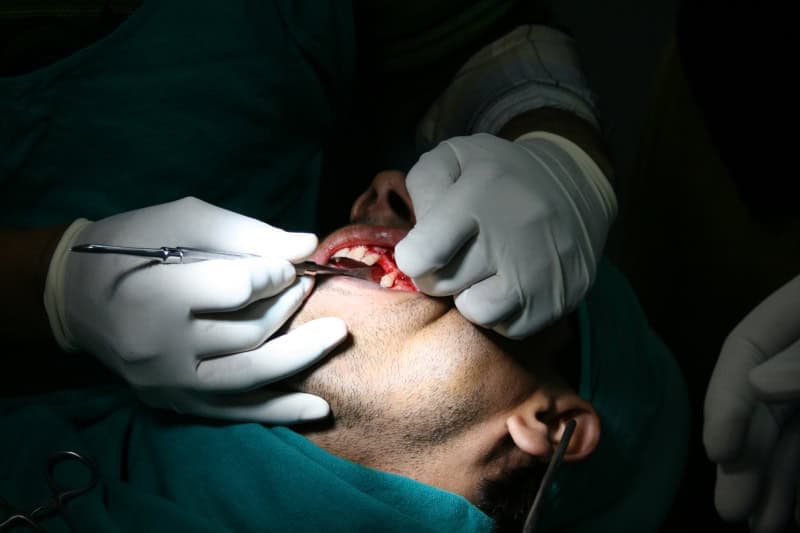 Dental procedure at Ludhiana Dental Centre in Ludhiana.
