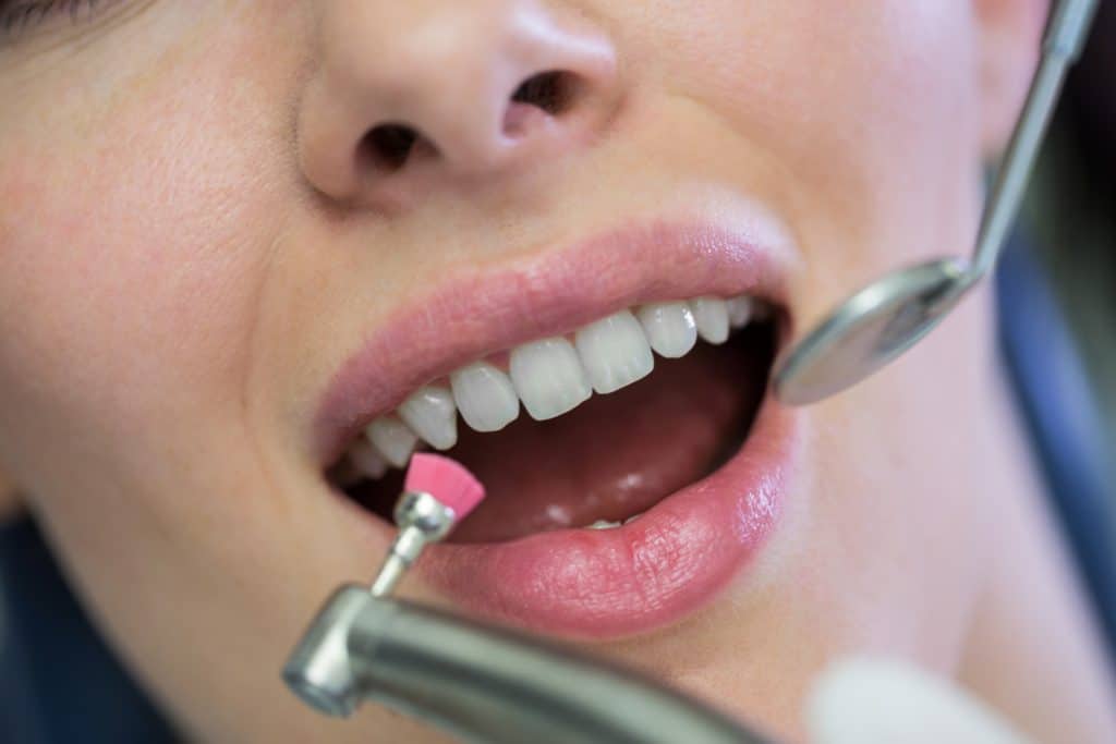Healthy patient receiving professional dental cleaning at Ludhiana Dental Centre, best dental care in Ludhiana.