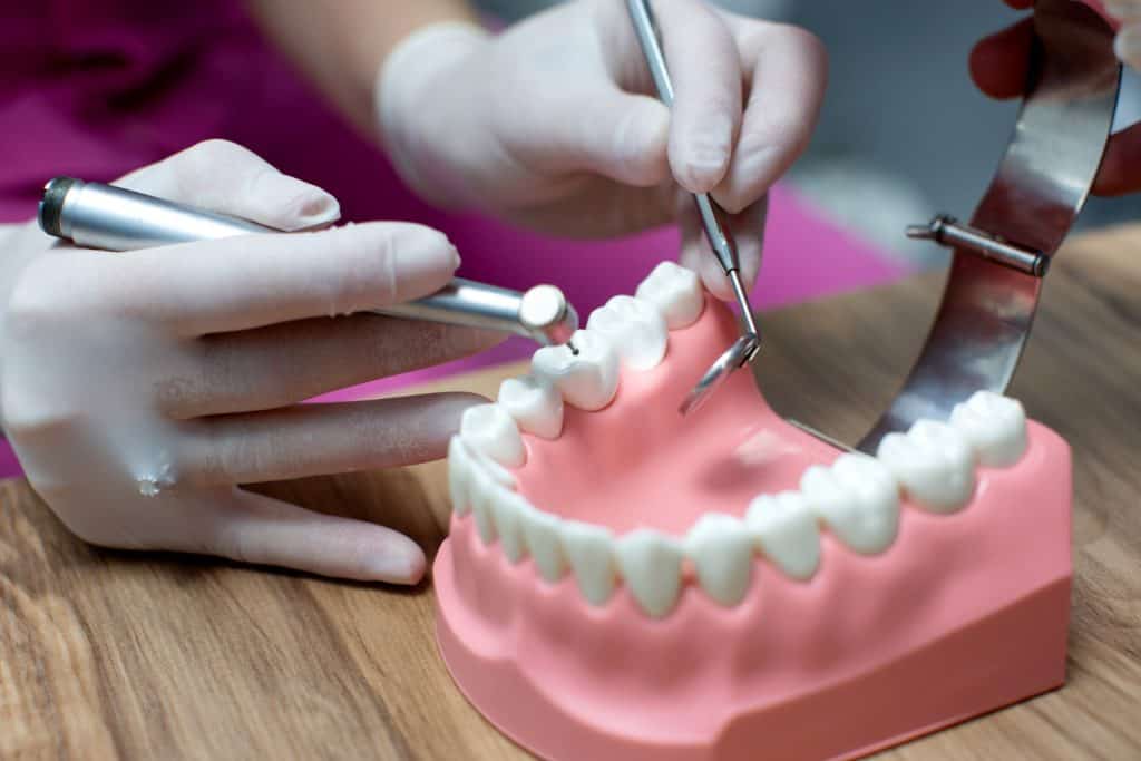 Dental implant procedure model at Ludhiana Dental Centre, advanced dental care in Ludhiana.