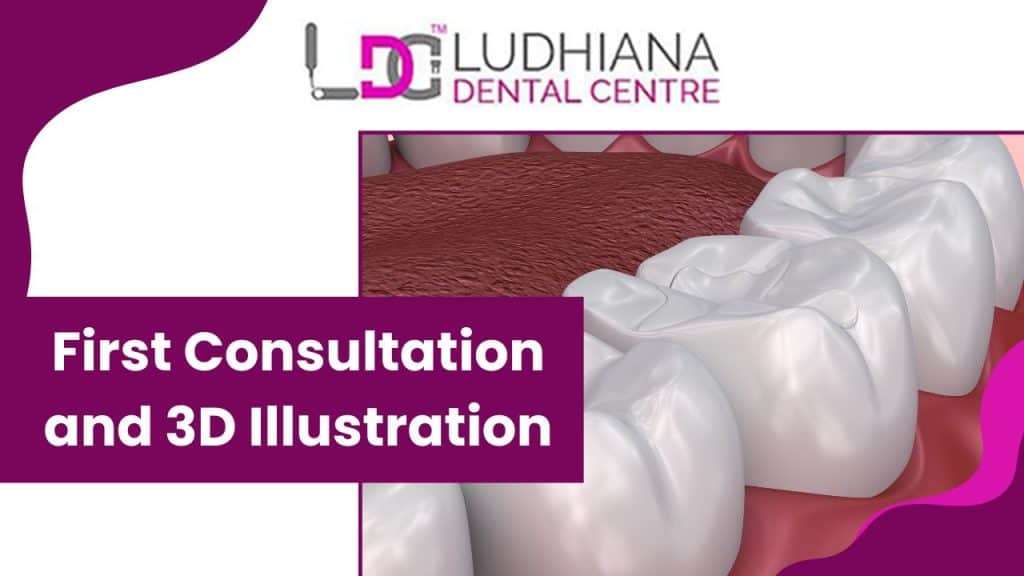 High-quality dental consultation and 3D teeth illustration at Ludhiana Dental Centre in Punjab.
