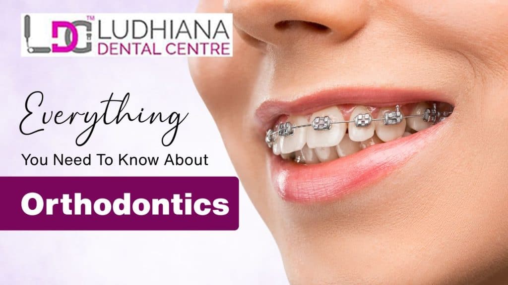 Braces-on-smiling-patient-ludhiana-dental-center.