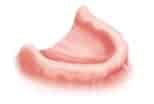 Clear dental denture for comfortable smile and oral health.