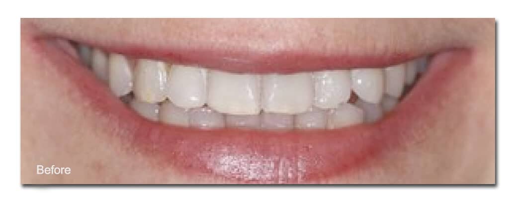 Etltowrickl fntuayo ahrad fetrniim le crateurso o nveni Asecrtni Xsje 100 characters.