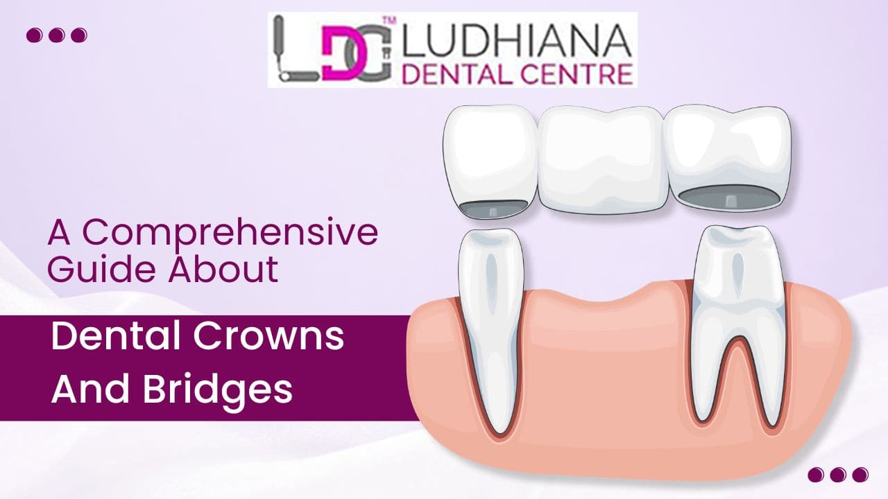 Illustration of dental crowns and bridges treatment with Ludhiana Dental Centre branding, showing a dental bridge placed over prepared teeth.