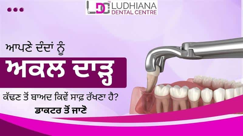 Tooth extraction dental clinic Ludhiana Dental Centre, teeth removal, oral surgery, high-quality dental care, Ludhiana.