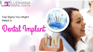 Dental implants at Ludhiana Dental Centre, top-rated dental clinic for tooth replacement solutions.