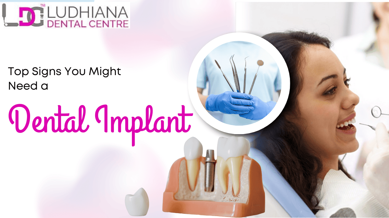 Dental implants at Ludhiana Dental Centre, top-rated dental clinic for tooth replacement solutions.