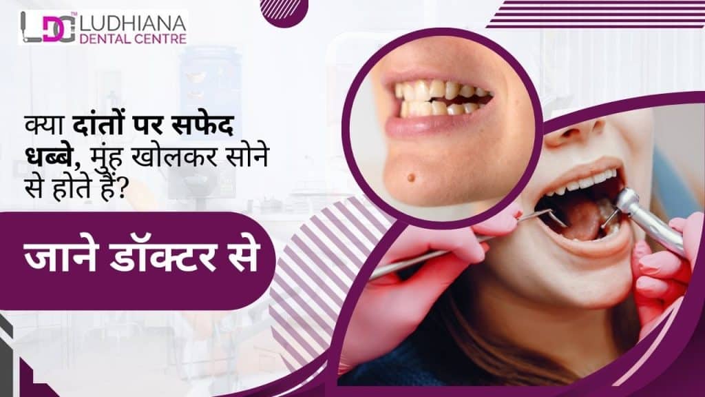 do-white-spots-on-teeth-occur-from-sleeping-with-your-mouth-open