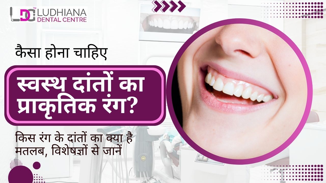 This image describe what should the natural colour of healthy teeth