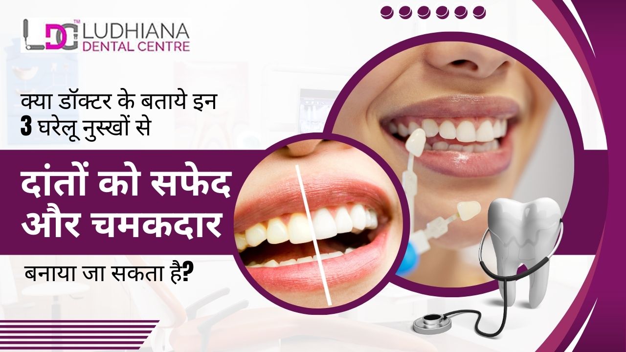 this image describes that 3 home remedies recommended by the doctor to make teeth shiny