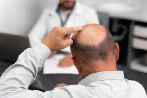 Consultation for Sapphire FUE hair transplant in Albania.