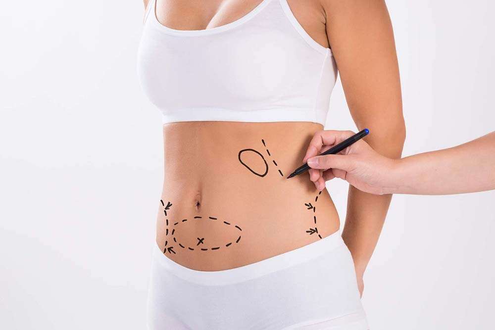 Body makeover moeder Albanië. 