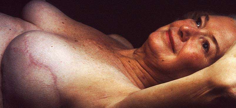 Breast reconstruction in Albania