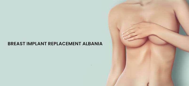 Αντικατάσταση εμφυτεύματος μαστού στην Αλβανία.