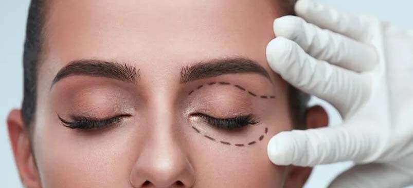 Réduction des paupières en Albanie (blépharoplastie)