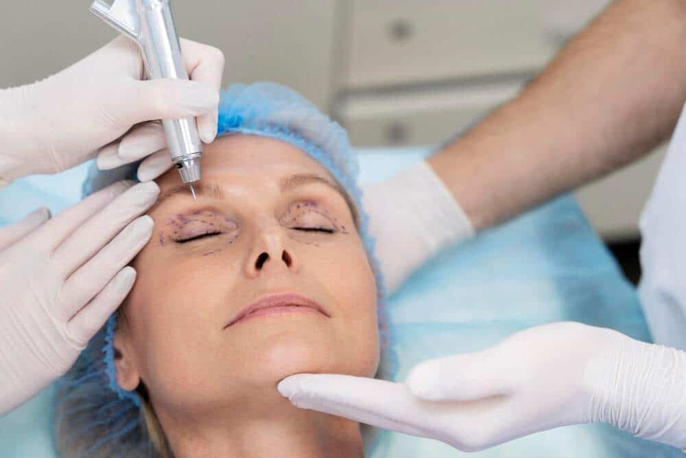 Améliorez votre apparence avec une blépharoplastie en Albanie, une destination de choix pour le tourisme médical.