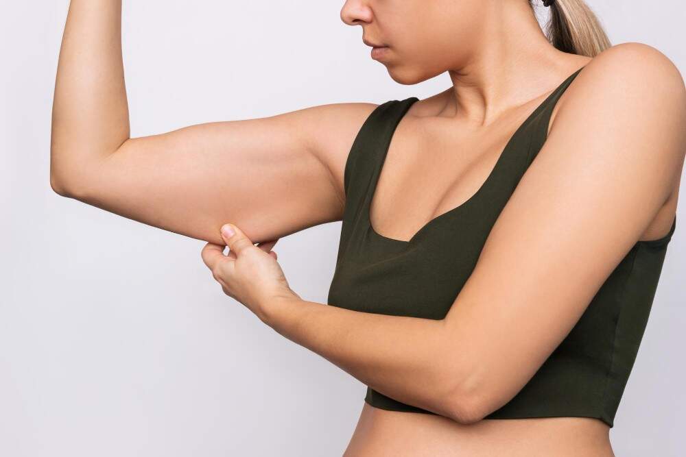 Vrouw toont armvet, zoekt naar behandelingsopties in Albanië voor het verwijderen van armvet.