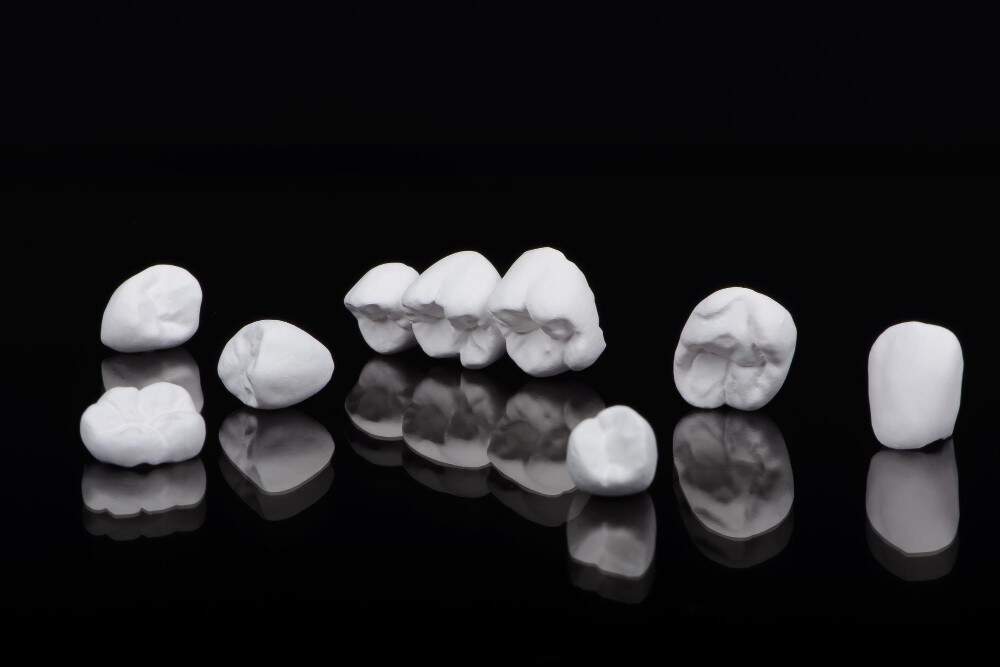 Kurora E-Max për restaurime dentare të qëndrueshme dhe estetike në Shqipëri.