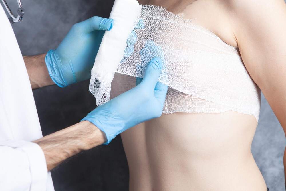 Afbeelding van herstel plastische chirurgie borst