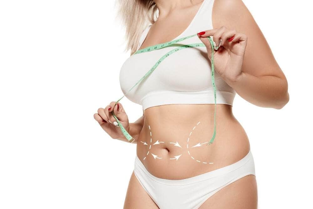 Suitable candidate for liposuction in Albania