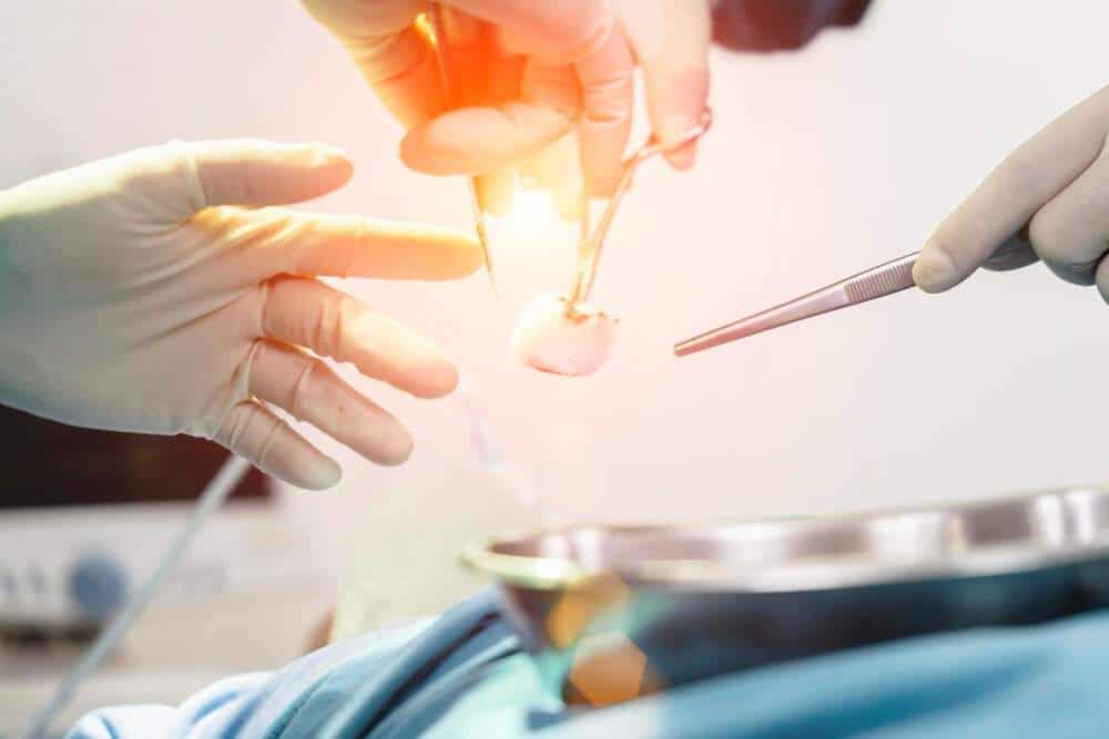 Dentista colocando implante dental durante un procedimiento de turismo médico en Albania.