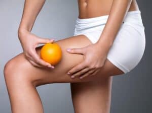 image illustrating a thigh lift in Albania