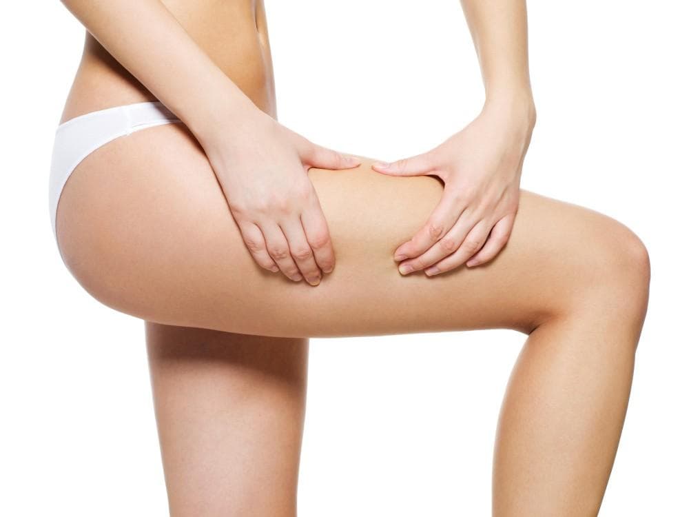 Woman's thigh showing smooth skin after thigh lift procedure for cellulite removal.
