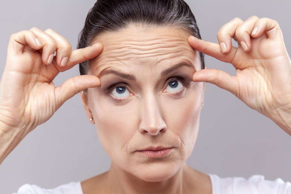 Woman showing forehead wrinkles, cosmetic facelift procedure in Albania.