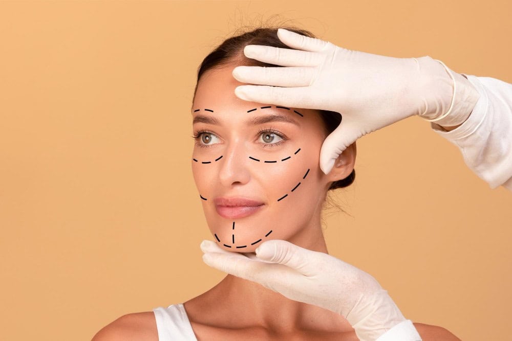 Woman preparing for plastic surgery with markings on her face, in Albania.